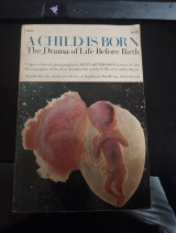 A Child Is Born - Lennart Nilsson (Vintage Έκδοση 1975)
