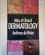 Atlas of Clinical Dermatology