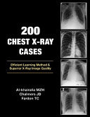 200, Chest X-Ray Cases